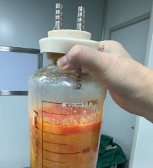 拉萨水动力吸脂手术要做多久？